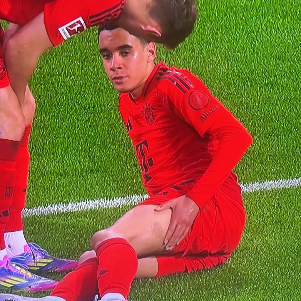 Jamal Musiala Exits with Hamstring Injury After Scoring Vital Goal for Bayern Munich